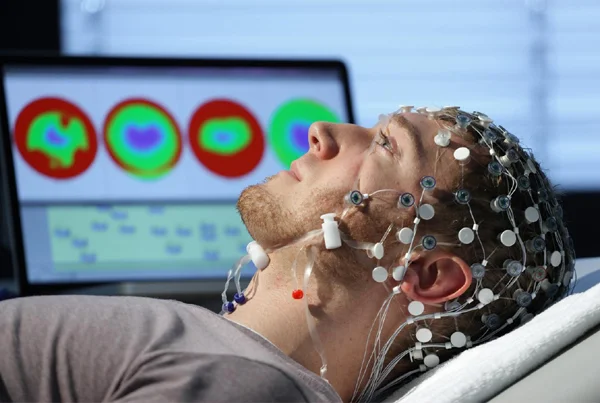 EEG Sleep Deprived